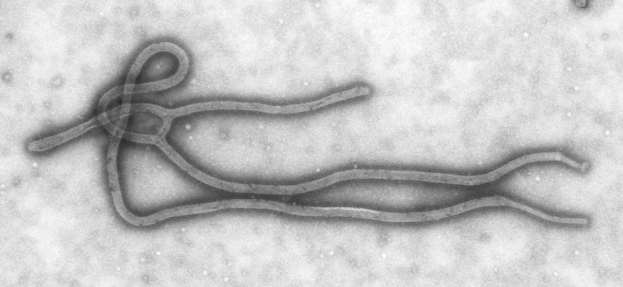 Nigeria xác nhận ca Ebola đầu tiên sau hơn một thập niên tại thủ đô Abuja